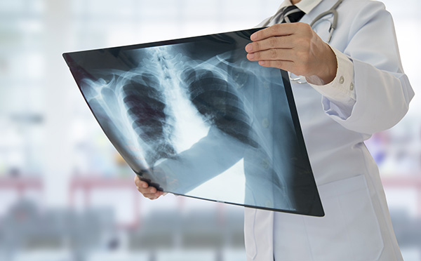 Image of a doctor holding an x-ray